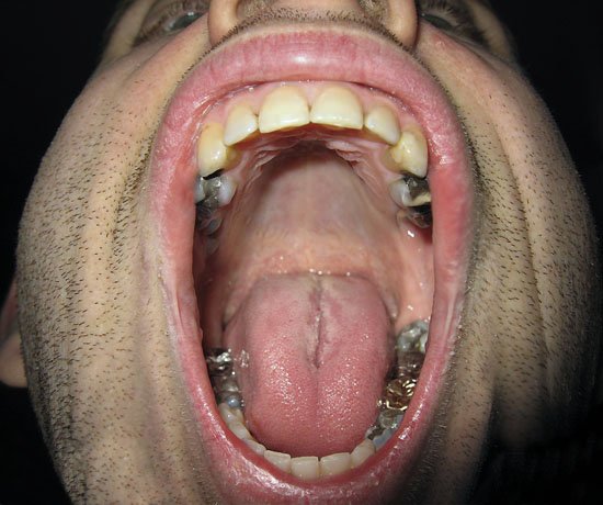 deep throat