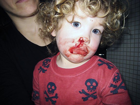 my bloody son