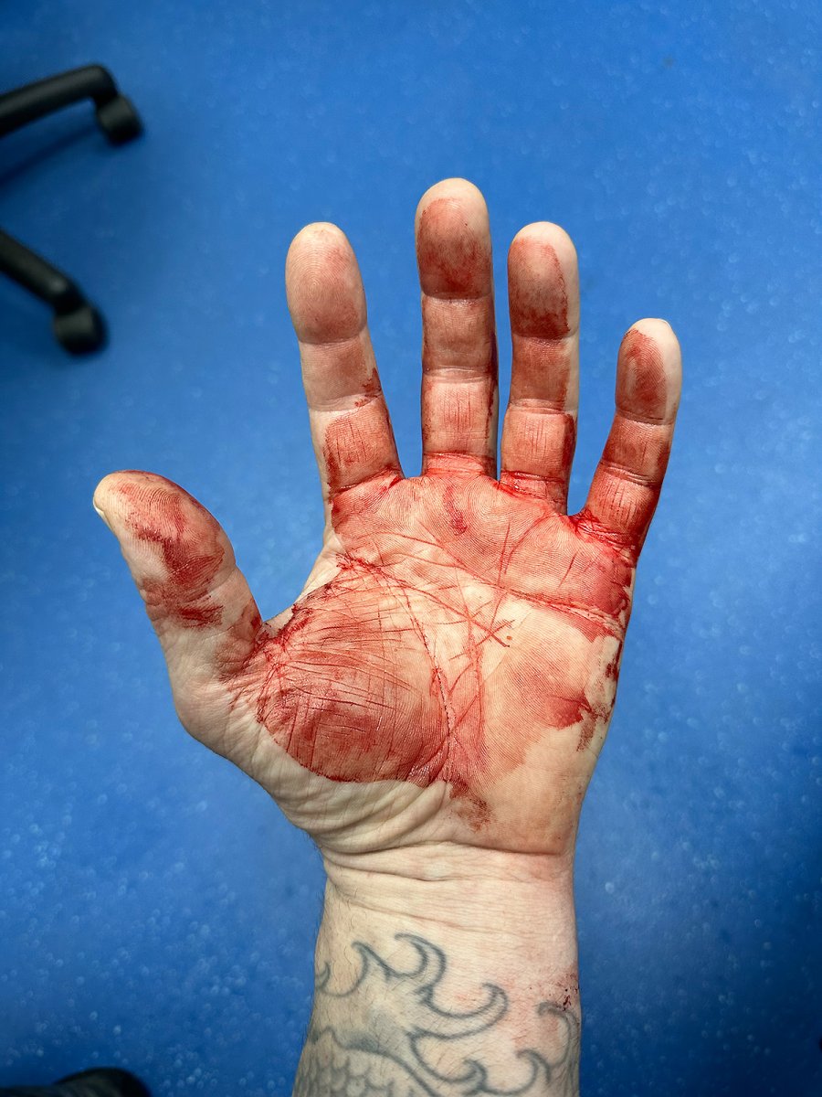 (my) blood on my hands