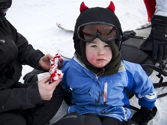 blood on the pistes, again