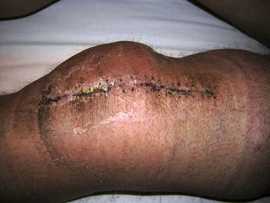 knee deep